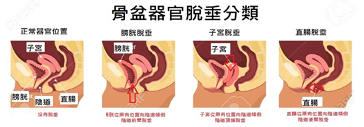 圖片1.png 圖片1.png